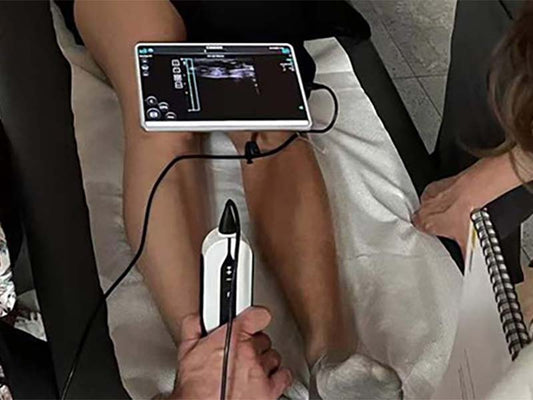 SonoEye Handheld Ultrasound in Plastic Surgery