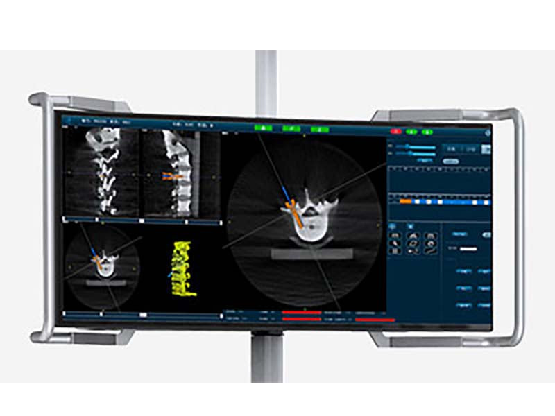 Perlove PL300B Spine Surgical Navigation System