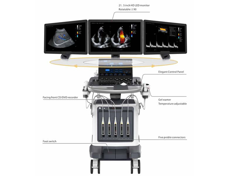 Zoncare ViV80 Ultrasound