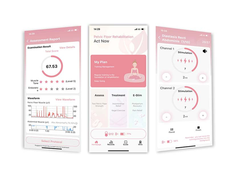 Edan Q Series Biofeedback and stimulation system