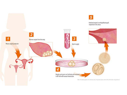 Kangjian IVF Multi-use Petri Dish Ø35×11 (Dish) (1)