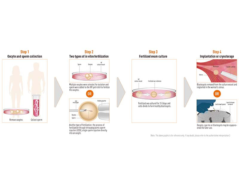 Kangjian IVF 4-Well Dish (1)