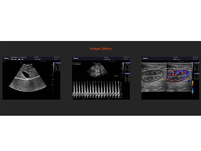 2. Acclarix LX9 VET  Veterinary Cart-based Color Ultrasound (1)