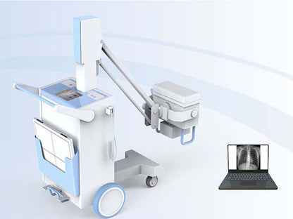 Perlove PLX5100 Mobile Digital Radiography System (1)