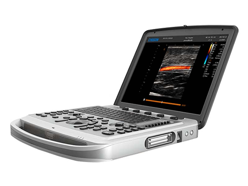 Chison SonoBook 6 Portable Color Ultrasound