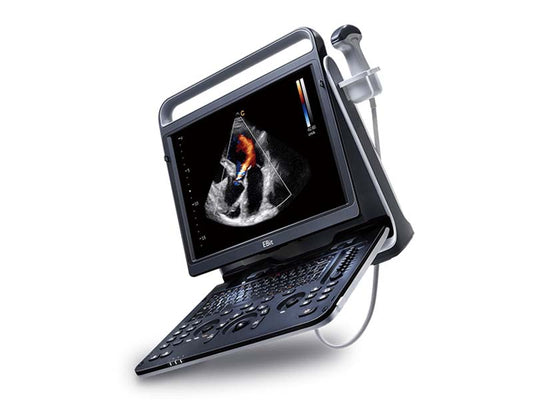 Chison EBit 60 Portable Color Ultrasound