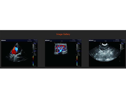 3. Acclarix LX3 VET Veterinary Cart-based Color Ultrasound (1)