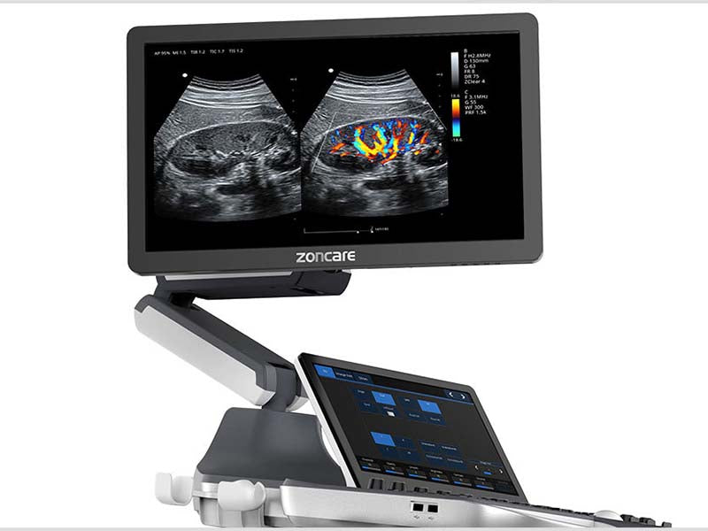 Zoncare ViV60 Cart-based Color Ultrasound