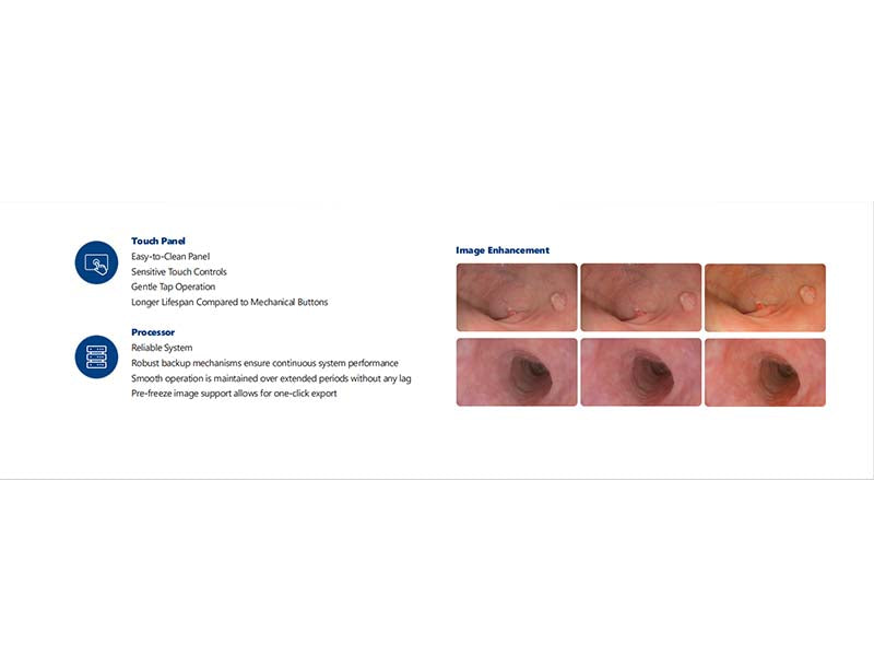 GHM-8000 max High-Definition Video Endoscopy System