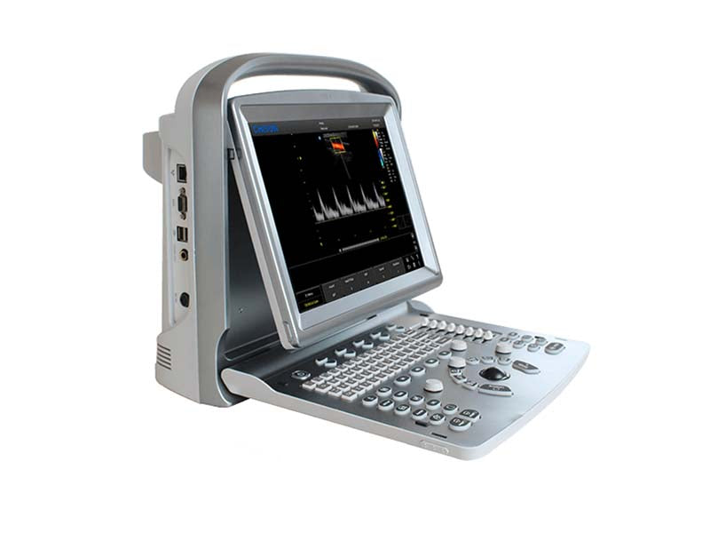 Chison  ECO 5 Portable Color Ultrasound