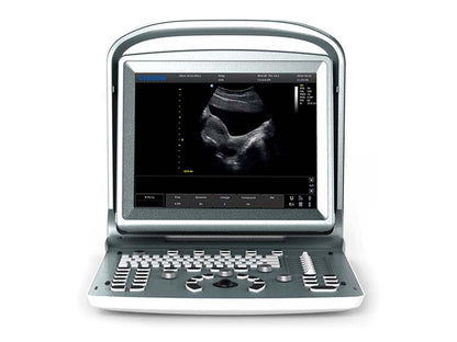 Chison  ECO 5 Portable Color Ultrasound