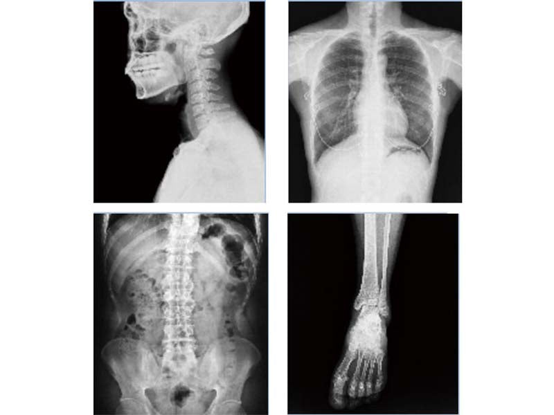 Perlove PLD7300D High Frequency Digital Radiography System (1)