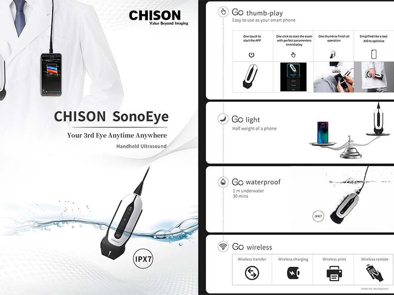 Chison  SonoEye P5 Handheld Ultrasound