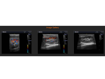 6. Acclarix AX3 VET Veterinary Portable Ultrasound (1)