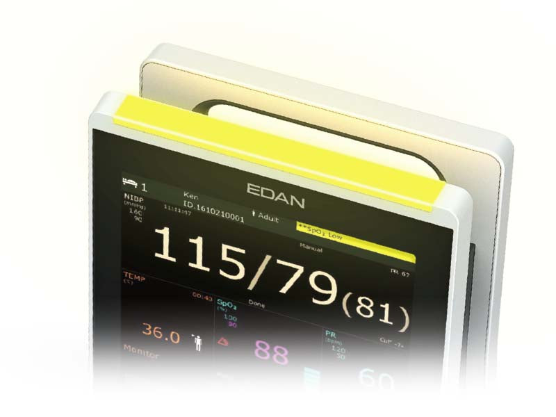 Edan iM3 Vital Signs Monitor