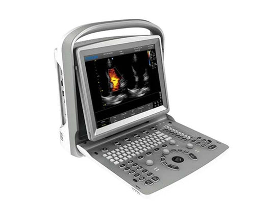 Chison  ECO 6 Portable Color Ultrasound