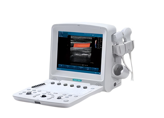 Edan U50 Portable Color Ultrasound