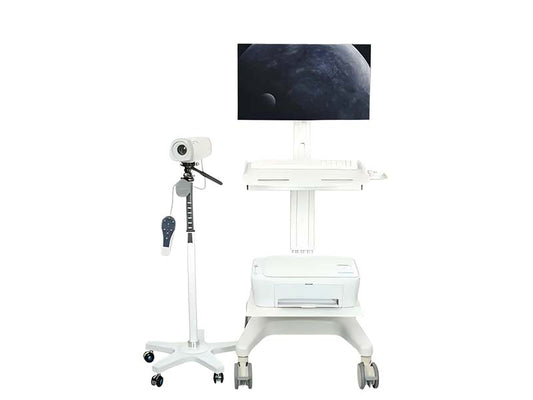 GHM-SY02 Digital Electronic Colposcope