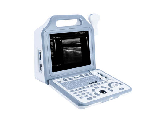 N2 Full Digital Diagnostic Ultrasound