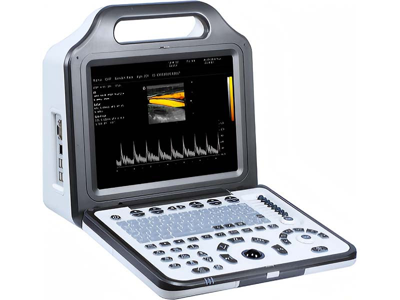 N5 Full Digital Diagnostic Ultrasound