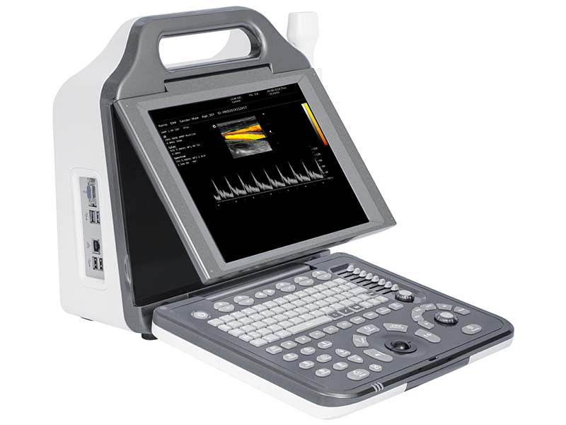 N5 Full Digital Diagnostic Ultrasound(No CE)